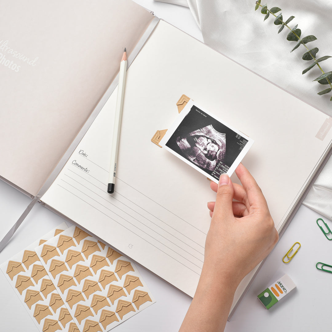Pregnancy Journal - Milestones Edition